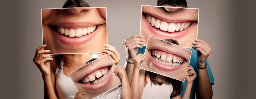 What is preventive Dental Care?